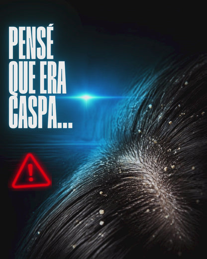 🛡️ ¡Dile Adiós A Los Piojos Sin Químicos!